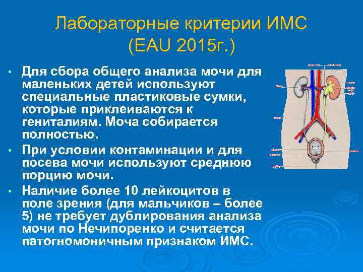 Лабораторные критерии ИМС (EAU 2015 г. ) Для сбора общего анализа мочи для маленьких