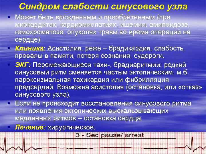 Синдром слабости синусового узла § Может быть врожденным и приобретенным (при миокардитах, кардиомиопатиях, ишемии,
