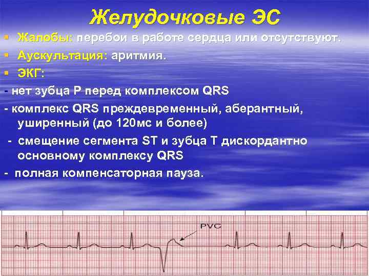 Желудочковые ЭС § Жалобы: перебои в работе сердца или отсутствуют. § Аускультация: аритмия. §