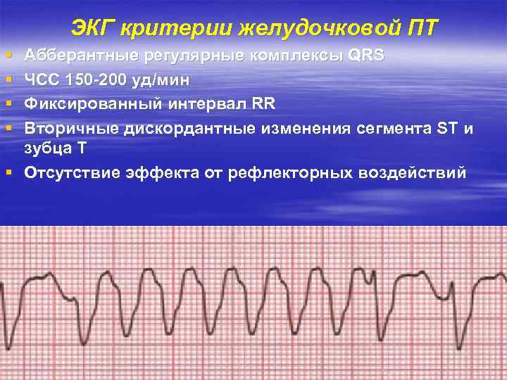 ЭКГ критерии желудочковой ПТ § § Абберантные регулярные комплексы QRS ЧСС 150 -200 уд/мин