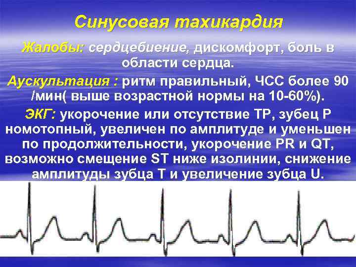 Синусовая тахикардия Жалобы: сердцебиение, дискомфорт, боль в области сердца. Аускультация : ритм правильный, ЧСС