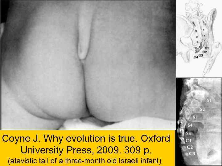 Coyne J. Why evolution is true. Oxford University Press, 2009. 309 p. (atavistic tail