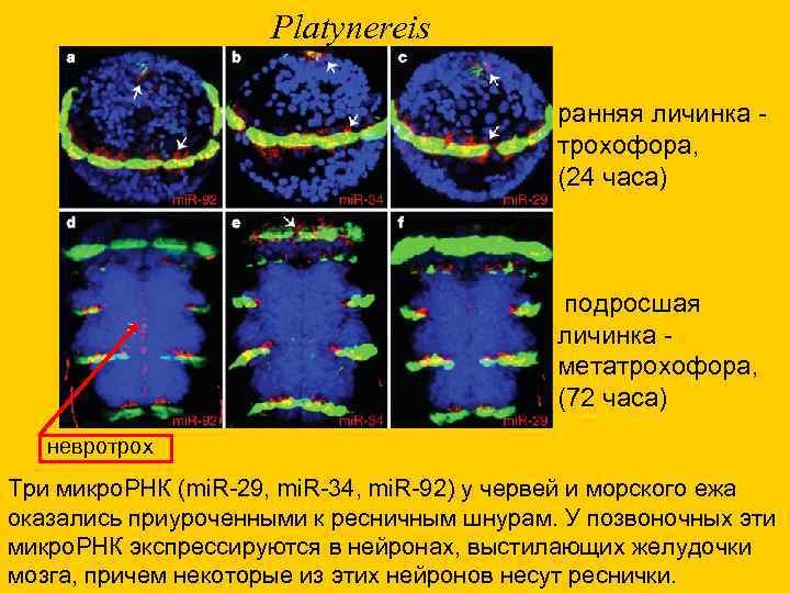 Platynereis ранняя личинка трохофора, (24 часа) подросшая личинка метатрохофора, (72 часа) невротрох Три микро.