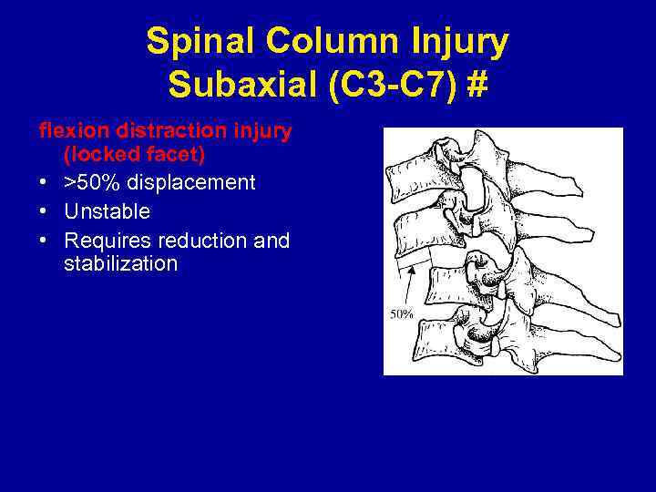 Spinal Column Injury Subaxial (C 3 -C 7) # flexion distraction injury (locked facet)