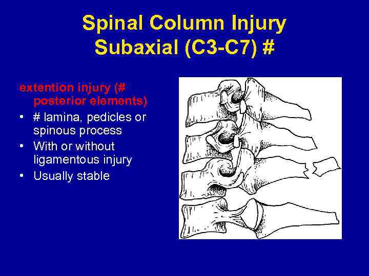 Spinal Column Injury Subaxial (C 3 -C 7) # extention injury (# posterior elements)