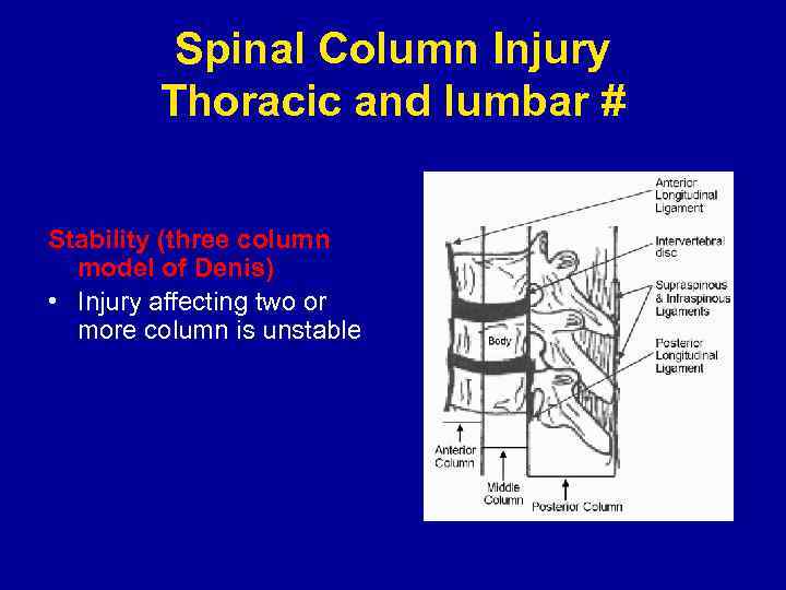 Column span. Three column technique phyhology. 3 Colum model vertebral column of Denis. Prevalence of Thoracic Trauma. D&D Spine of.