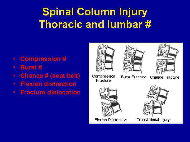 Spinal Column Injury Thoracic and lumbar # • • • Compression # Burst #