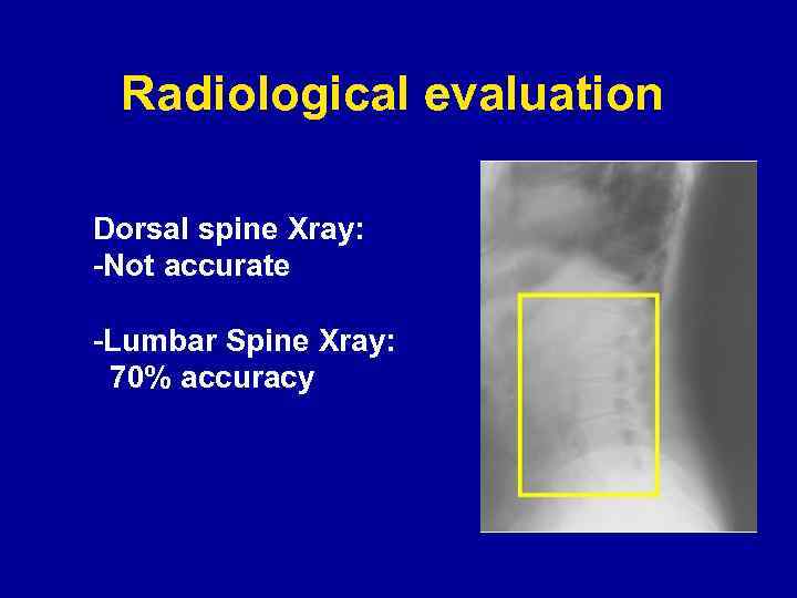 Radiological evaluation Dorsal spine Xray: -Not accurate -Lumbar Spine Xray: 70% accuracy 