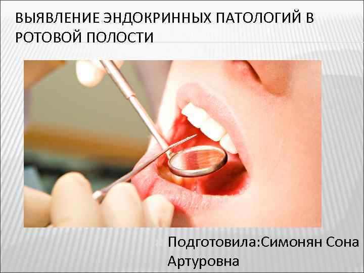 ВЫЯВЛЕНИЕ ЭНДОКРИННЫХ ПАТОЛОГИЙ В РОТОВОЙ ПОЛОСТИ Подготовила: Симонян Сона Артуровна 