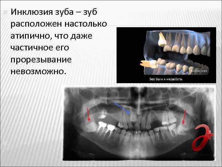 Аномалии Зубов Фото