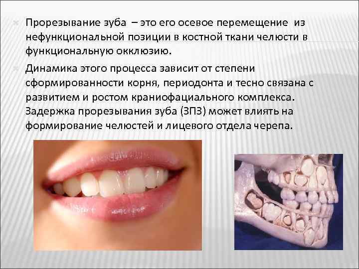  Прорезывание зуба – это его осевое перемещение из нефункциональной позиции в костной ткани