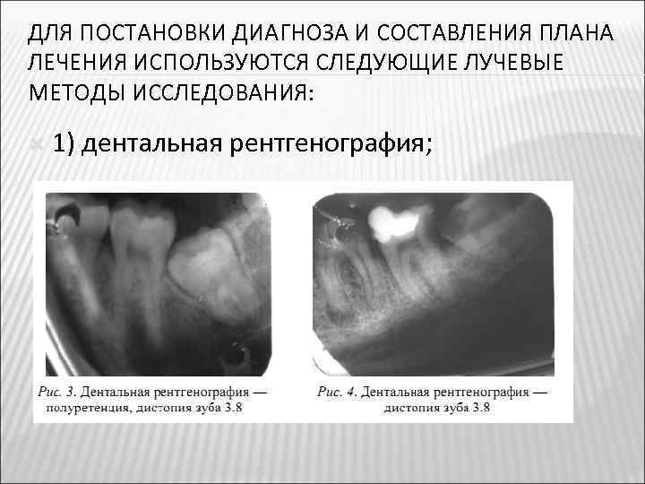 ДЛЯ ПОСТАНОВКИ ДИАГНОЗА И СОСТАВЛЕНИЯ ПЛАНА ЛЕЧЕНИЯ ИСПОЛЬЗУЮТСЯ СЛЕДУЮЩИЕ ЛУЧЕВЫЕ МЕТОДЫ ИССЛЕДОВАНИЯ: 1) дентальная