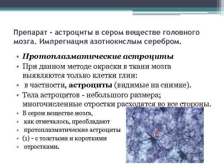 Препарат - астроциты в сером веществе головного мозга. Импрегнация азотнокислым серебром. • Протоплазматические астроциты