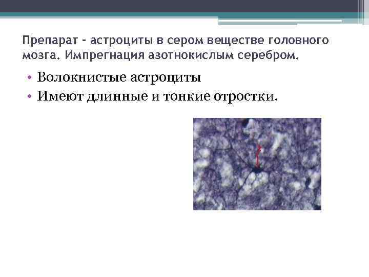 Препарат - астроциты в сером веществе головного мозга. Импрегнация азотнокислым серебром. • Волокнистые астроциты