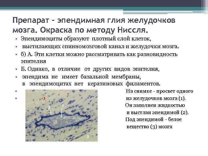 Препарат - эпендимная глия желудочков мозга. Окраска по методу Ниссля. • Эпендимоциты образуют плотный