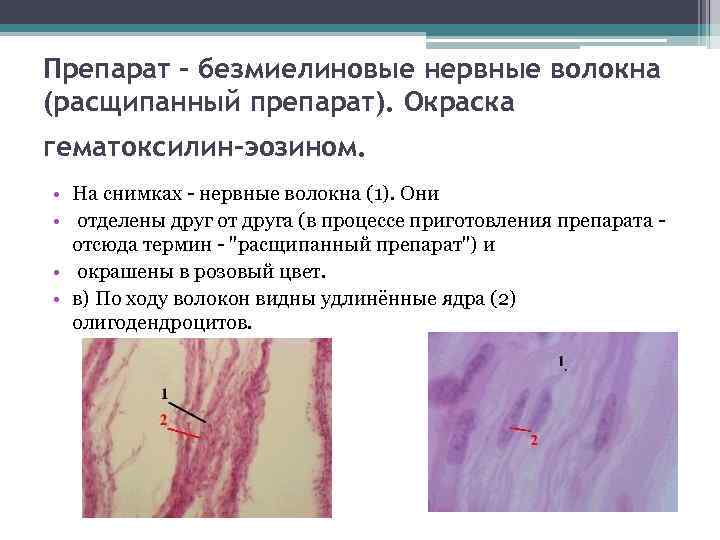 Препарат - безмиелиновые нервные волокна (расщипанный препарат). Окраска гематоксилин-эозином. • На снимках - нервные