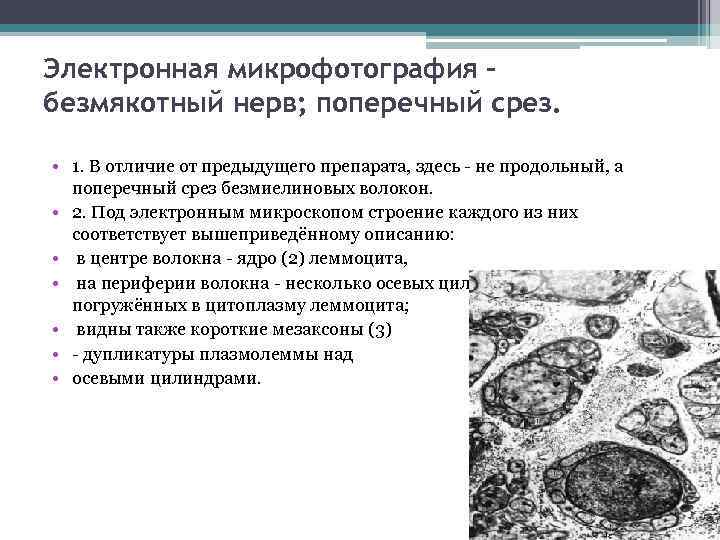 Электронная микрофотография безмякотный нерв; поперечный срез. • 1. В отличие от предыдущего препарата, здесь