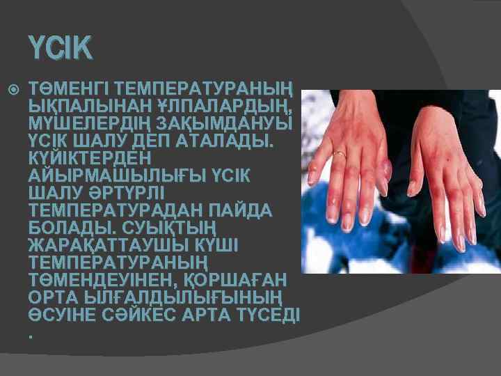 ҮСІК ТӨМЕНГІ ТЕМПЕРАТУРАНЫҢ ЫҚПАЛЫНАН ҰЛПАЛАРДЫҢ, МҮШЕЛЕРДІҢ ЗАҚЫМДАНУЫ ҮСІК ШАЛУ ДЕП АТАЛАДЫ. КҮЙІКТЕРДЕН АЙЫРМАШЫЛЫҒЫ ҮСІК