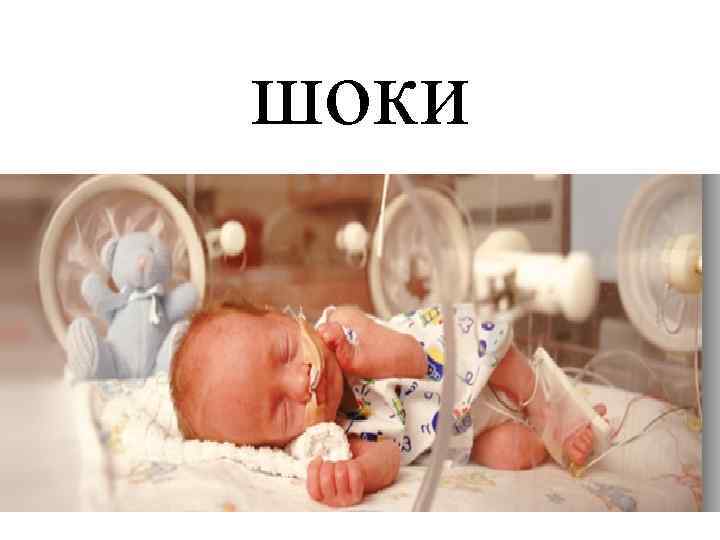 шоки 
