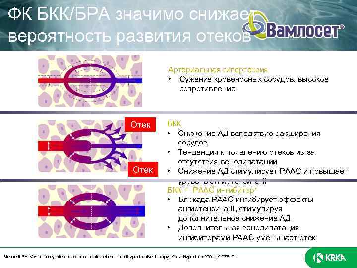 ФК БКК/БРА значимо снижает вероятность развития отеков I. II. Артериальная гипертензия • Сужение кровеносных