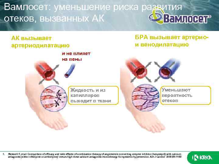 Вамлосет: уменьшение риска развития отеков, вызванных АК БРА вызывает артериои венодилатацию АК вызывает артериодилатацию