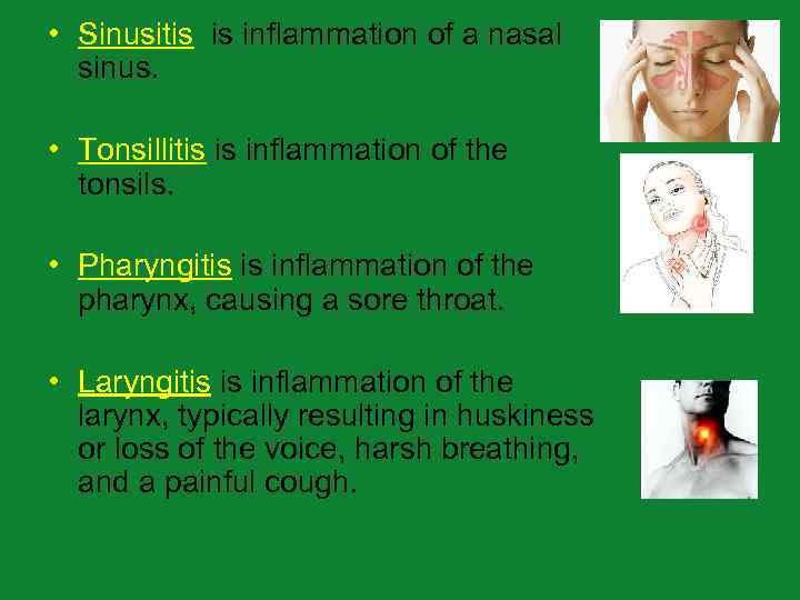  • Sinusitis is inflammation of a nasal sinus. • Tonsillitis is inflammation of