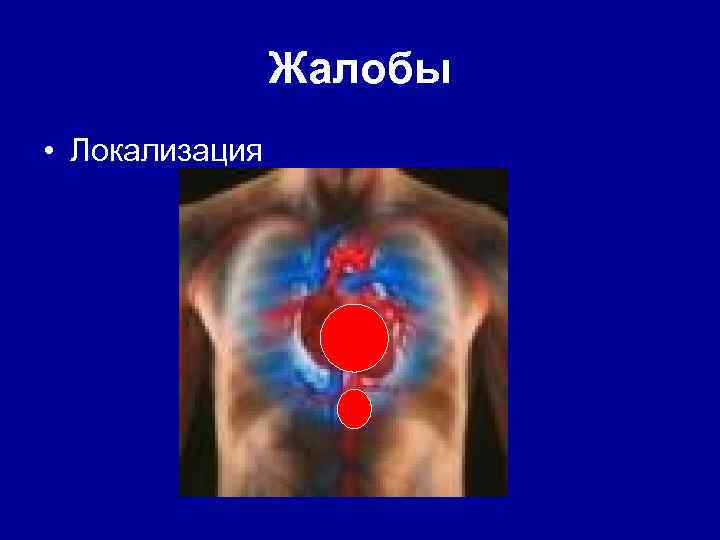 Жалобы • Локализация 