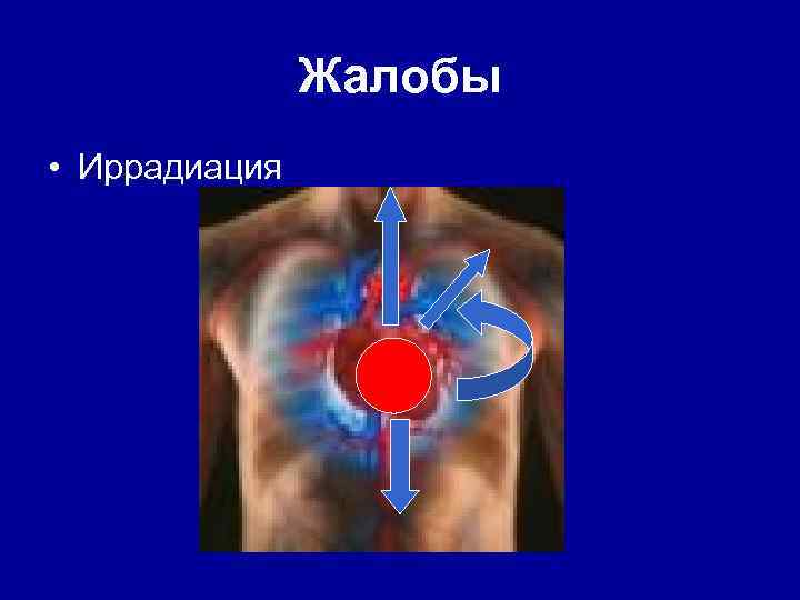 Жалобы • Иррадиация 