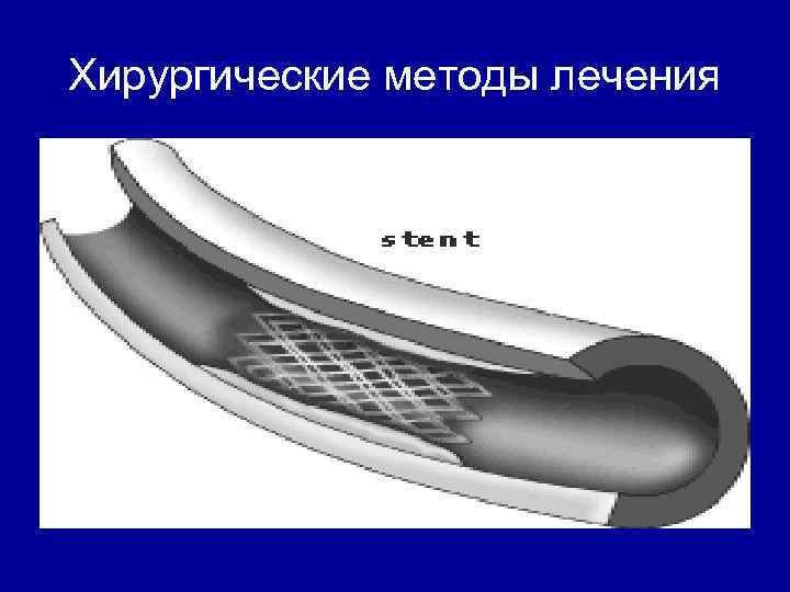 Хирургические методы лечения 