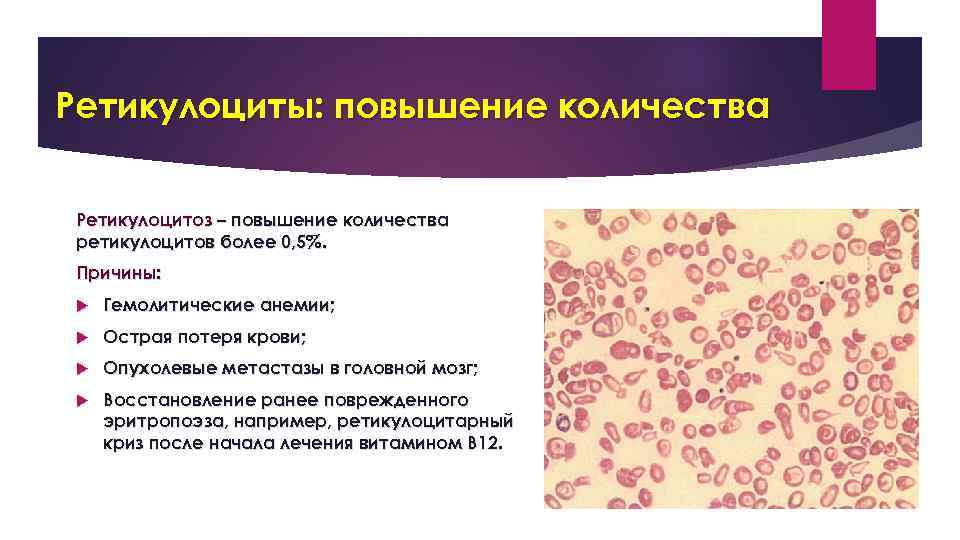 Повышено количество. Причины повышения ретикулоцитов. Повышение количества ретикулоцитов. Повышение уровня ретикулоцитов в крови характерно для. Снижение количества ретикулоцитов.