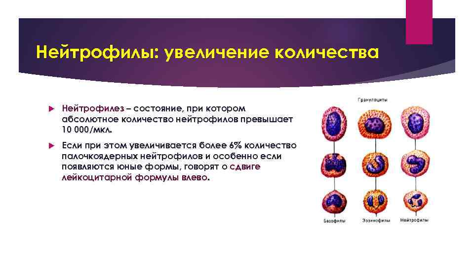 Нейтрофилы: увеличение количества Нейтрофилез – состояние, при котором абсолютное количество нейтрофилов превышает 10 000/мкл.