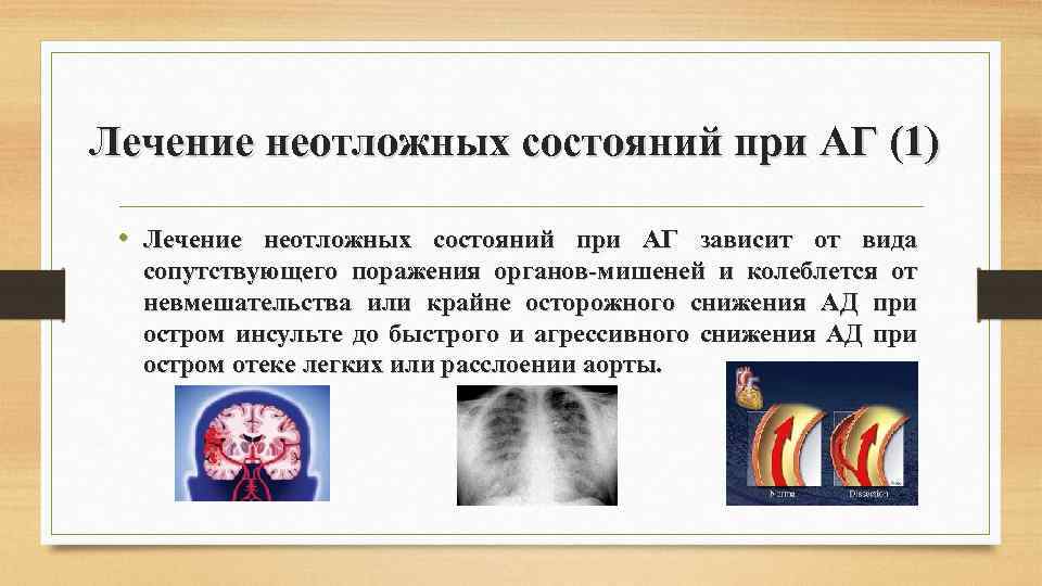Лечение неотложных состояний при АГ (1) • Лечение неотложных состояний при АГ зависит от