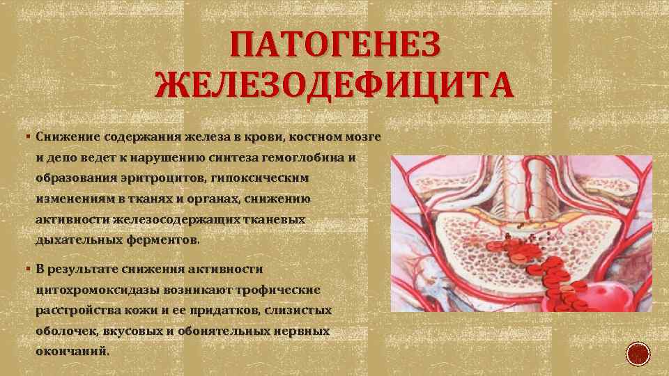 Уменьшение желез. Патогенез железодефицитной анемии. Патогенез жда. Этиопатогенез железодефицитной анемии. Патогенез дефицита железа.