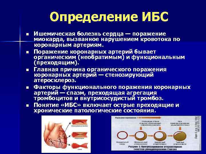 Определение ИБС n n n Ишемическая болезнь сердца — поражение миокарда, вызванное нарушением кровотока