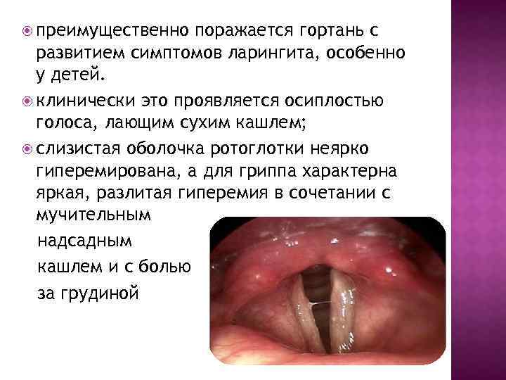  преимущественно поражается гортань с развитием симптомов ларингита, особенно у детей. клинически это проявляется