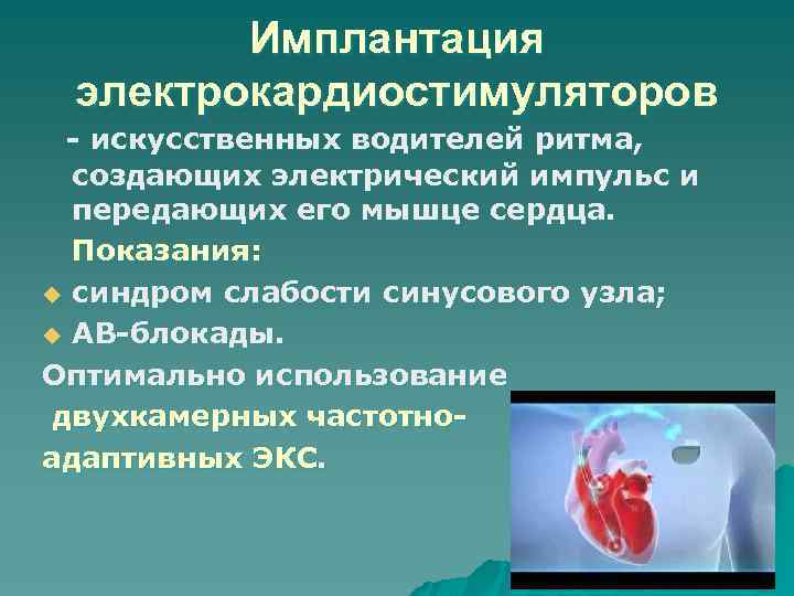 Имплантация электрокардиостимуляторов - искусственных водителей ритма, создающих электрический импульс и передающих его мышце сердца.
