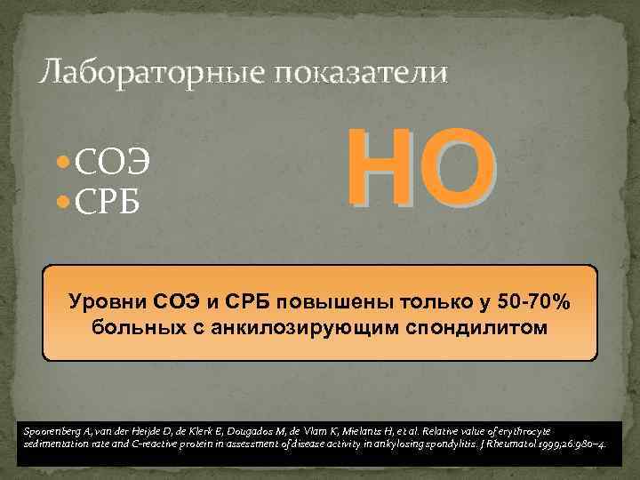 Лабораторные показатели СОЭ СРБ НО Уровни СОЭ и СРБ повышены только у 50 -70%