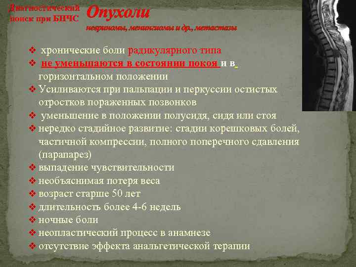 Диагностический поиск при БНЧС Опухоли невриномы, менингиомы и др. , метастазы v хронические боли
