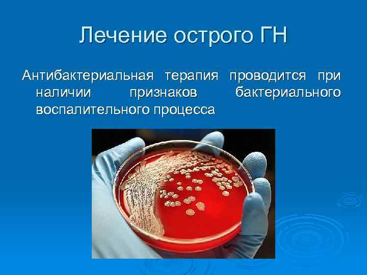 Лечение острого ГН Антибактериальная терапия проводится при наличии признаков бактериального воспалительного процесса 