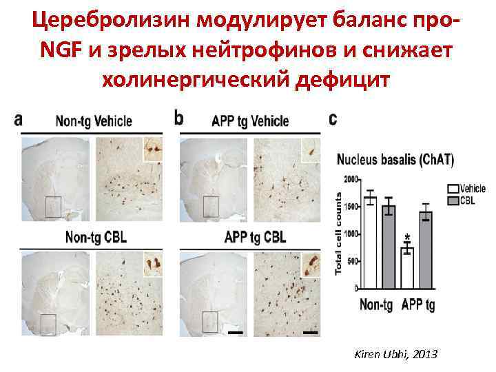 Церебролизин модулирует баланс про. NGF и зрелых нейтрофинов и снижает холинергический дефицит Kiren Ubhi,