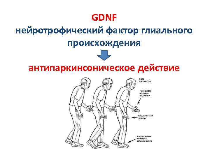 GDNF нейротрофический фактор глиального происхождения антипаркинсоническое действие 