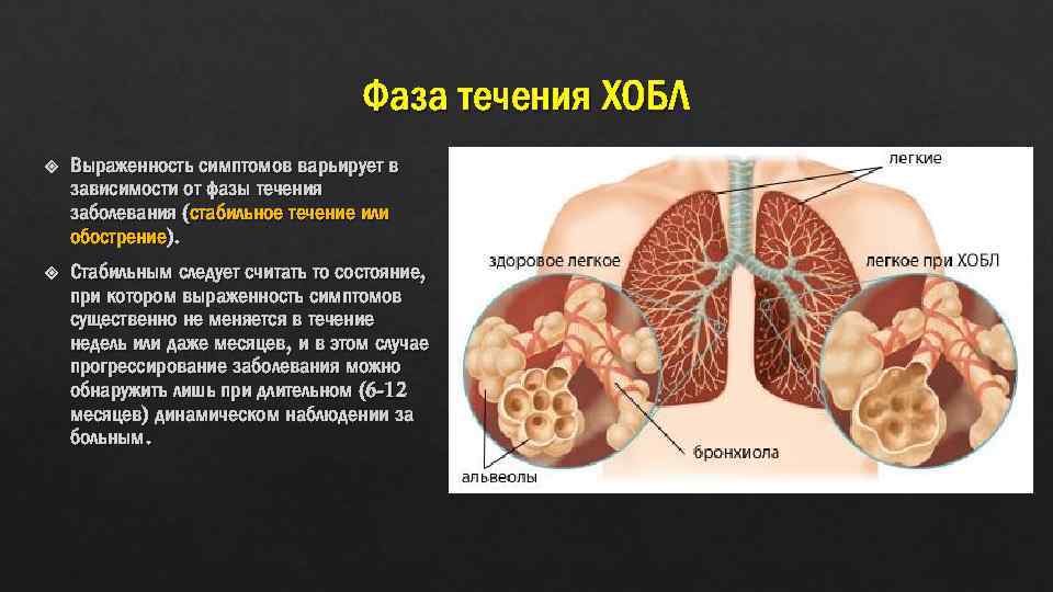 Хроническая обструктивная болезнь легких что это такое