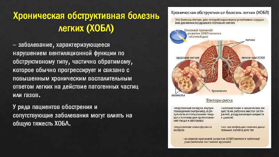 Хроническая обструктивная болезнь легких (ХОБЛ) – заболевание, характеризующееся нарушением вентиляционной функции по обструктивному типу,