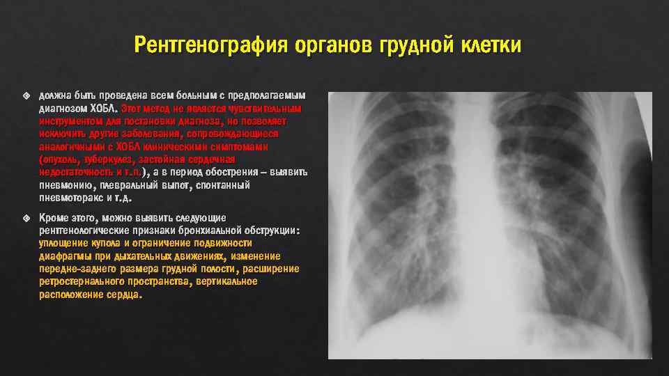 Что показывает рентген при кашле. Рентгенография органов грудной клетки при ХОБЛ. Рентгенологические признаки заболеваний органов грудной клетки..