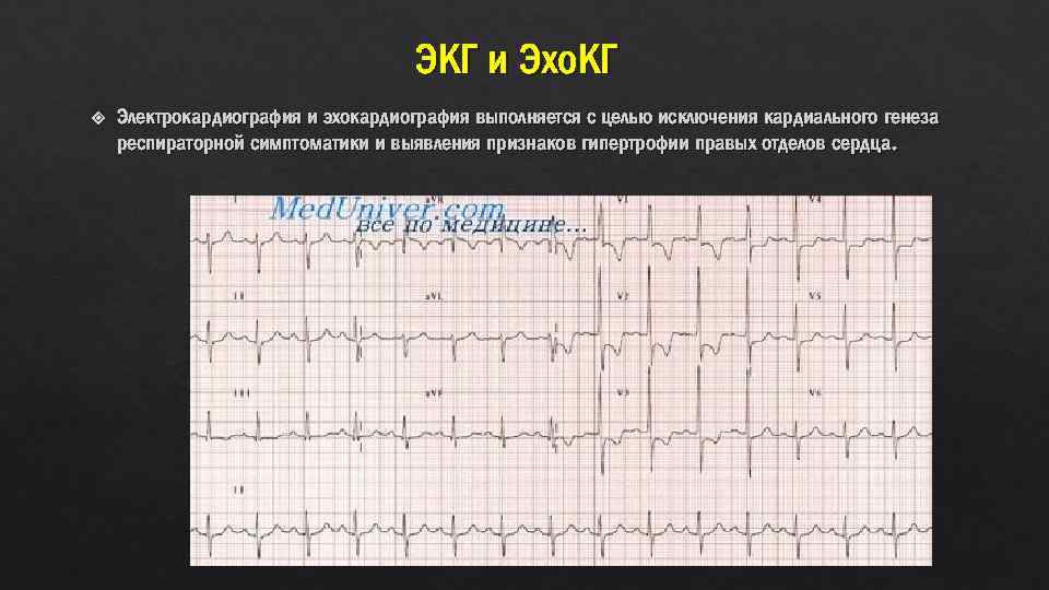 Узи экг. ЭКГ И ЭХОКГ. Эхокардиография ЭКГ. Эхокардиография сердца это ЭКГ. Эхокардиография и ЭКГ разница.