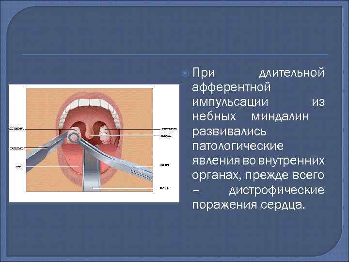 Строение миндалин схема у взрослых