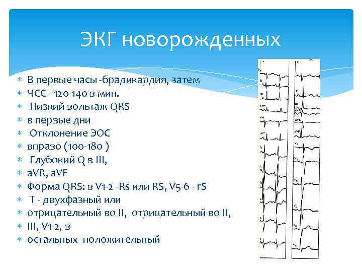 ЭКГ новорожденных В первые часы -брадикардия, затем ЧСС - 120 -140 в мин. Низкий