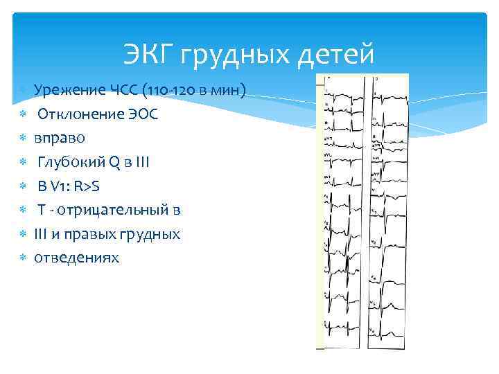 ЭКГ грудных детей Урежение ЧСС (110 -120 в мин) Отклонение ЭОС вправо Глубокий Q