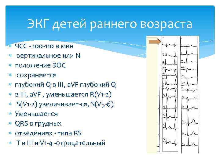 ЭКГ детей раннего возраста ЧСС - 100 -110 в мин вертикальное или N положение