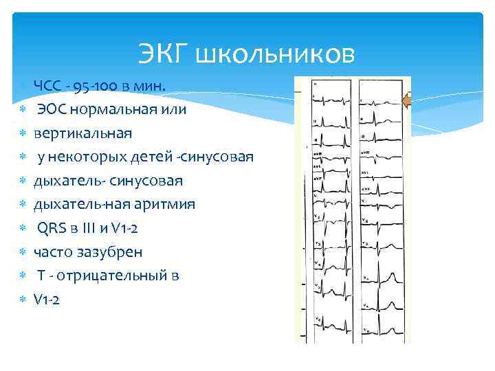 ЭКГ школьников ЧСС - 95 -100 в мин. ЭОС нормальная или вертикальная у некоторых